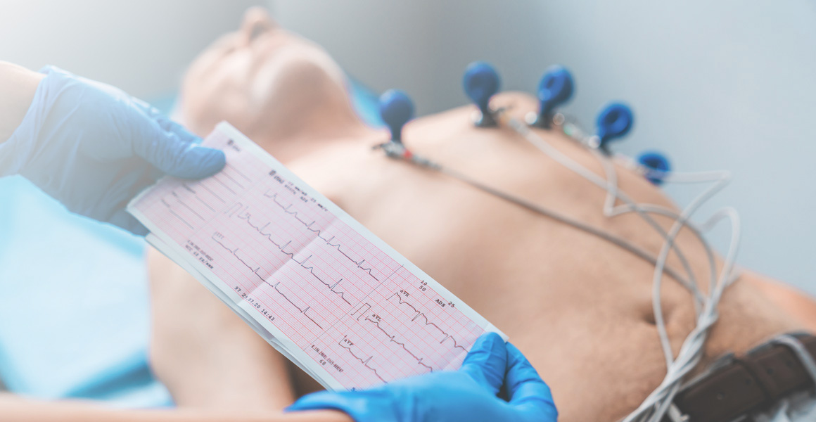 Электрокардиография (ЭКГ)